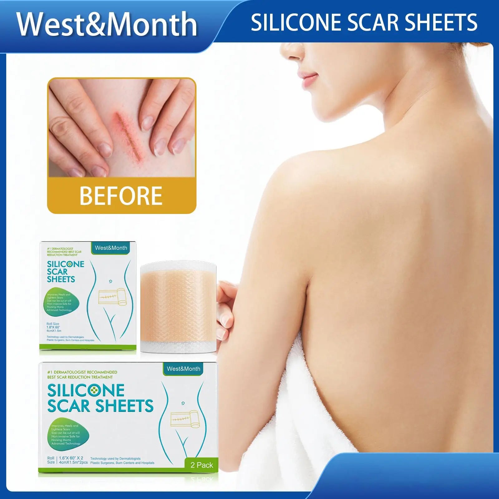Silicon Scar Tape - Image 4