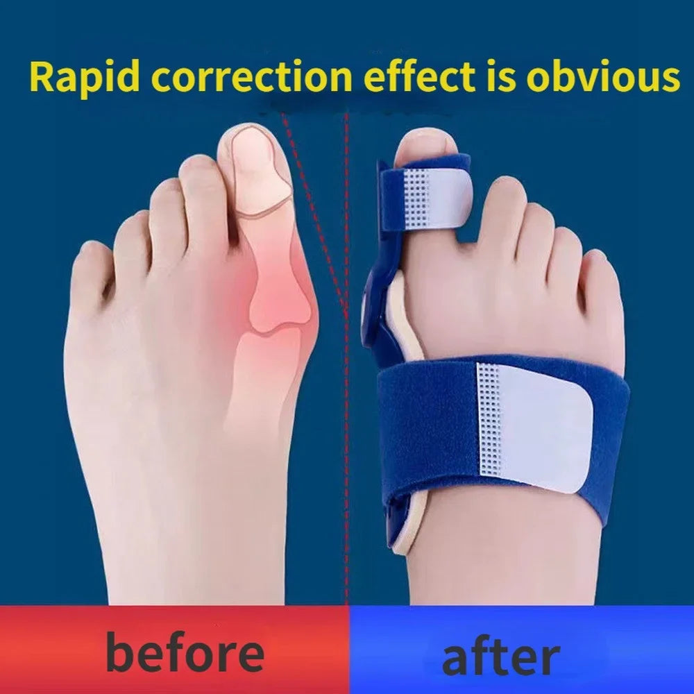 Flexfix Toe Splint - Image 7