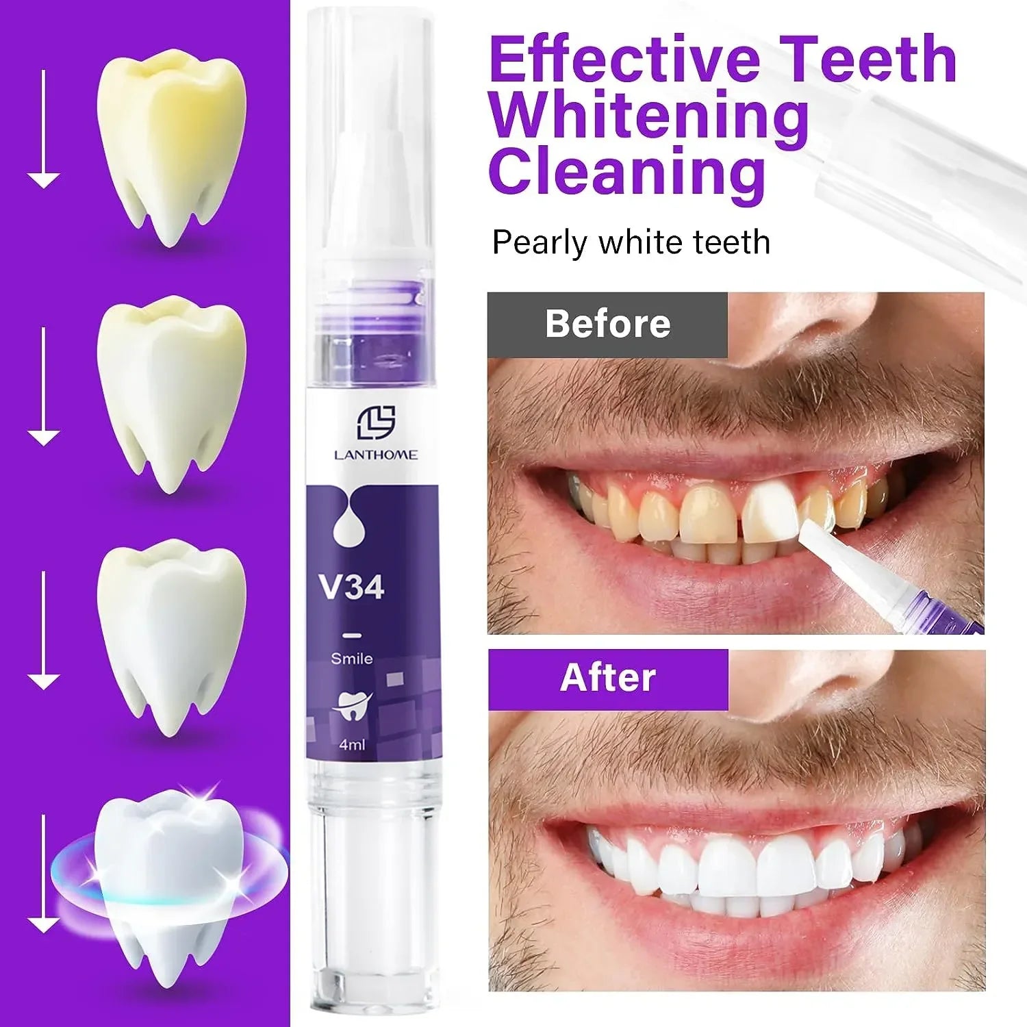 Whitening Dental Gel Pen - Image 8