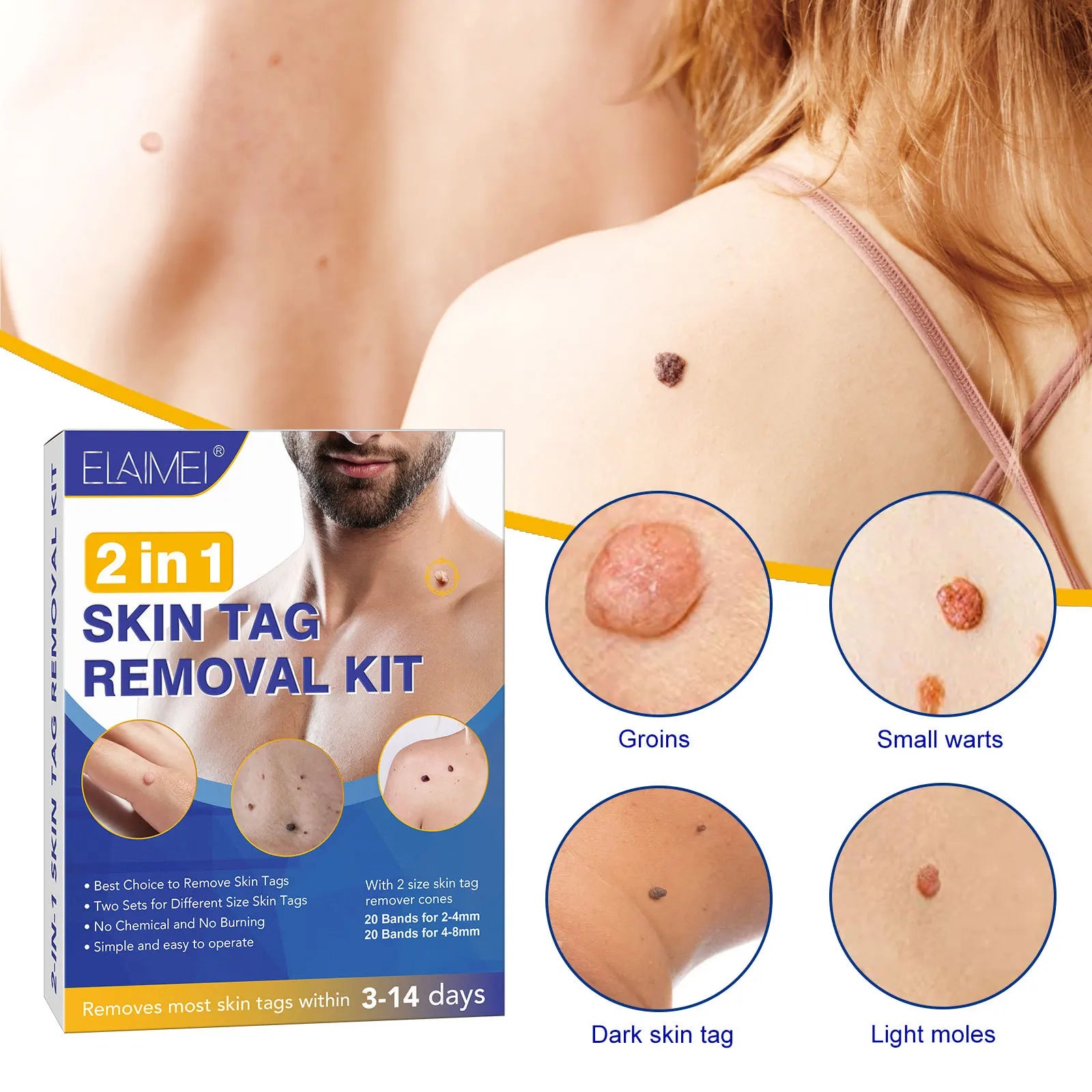 Skin Tag Removal Kit - Image 5