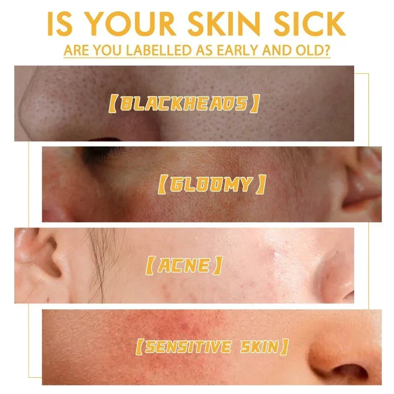 Honey Tearing Mask - Image 5