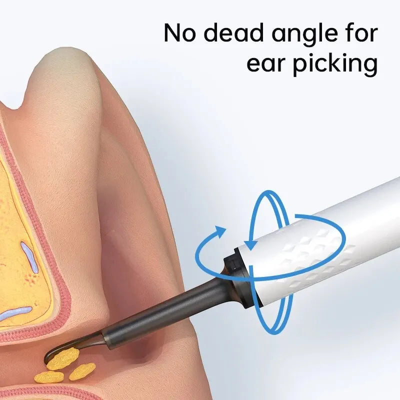 Wireless Endoscope Hd Ear Pick Set - Image 4
