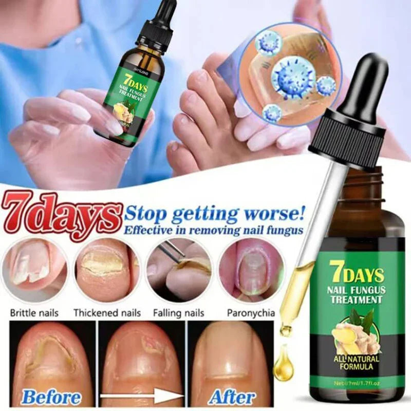 Nail Fungus Defender Serum - Image 3