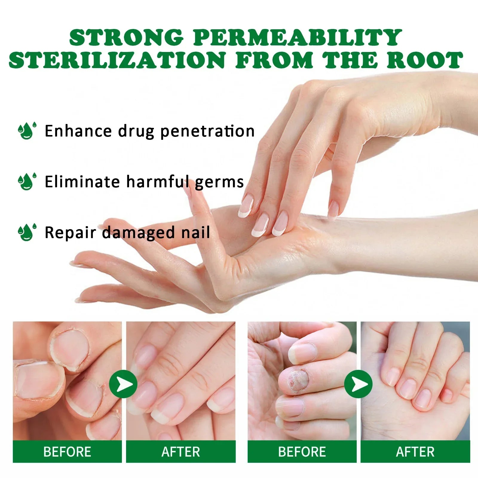 Nail Fungus Defender Serum - Image 6