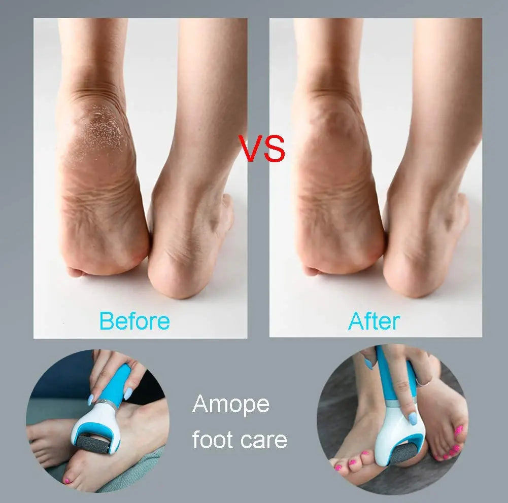 Usb Foot Callus Remover Pedicure Tool - Image 11