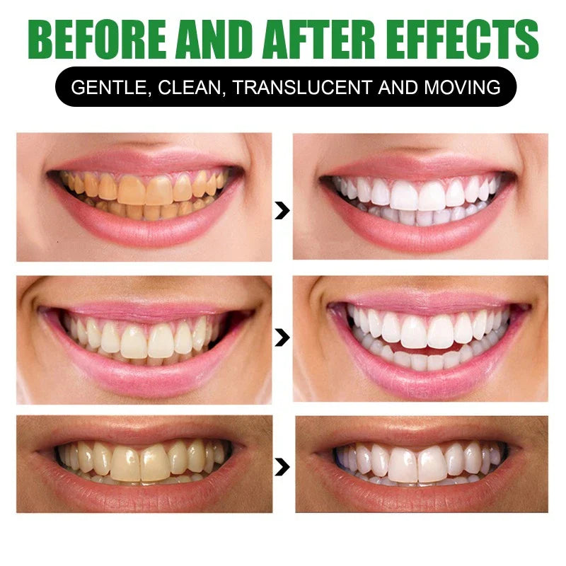 Bamboo Charcoal Teeth Whitening Toothpaste - Image 6