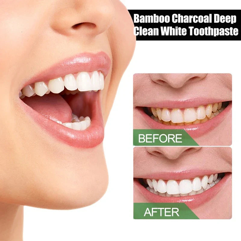 Bamboo Charcoal Teeth Whitening Toothpaste - Image 4