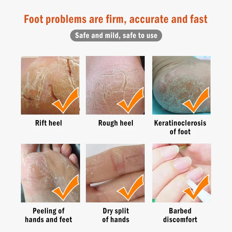 Dead Skin Remover Crack Cream - Image 8