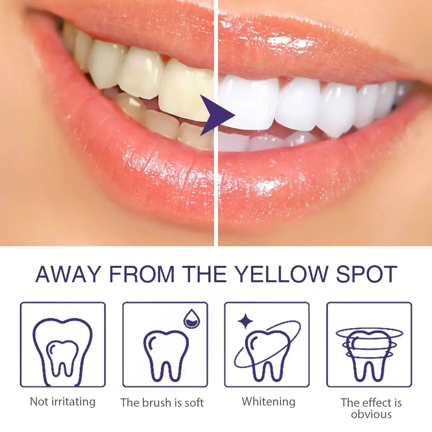 Whitening Dental Gel Pen - Image 10