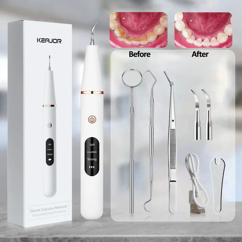 Electric Dental Calculus Remover - Image 10