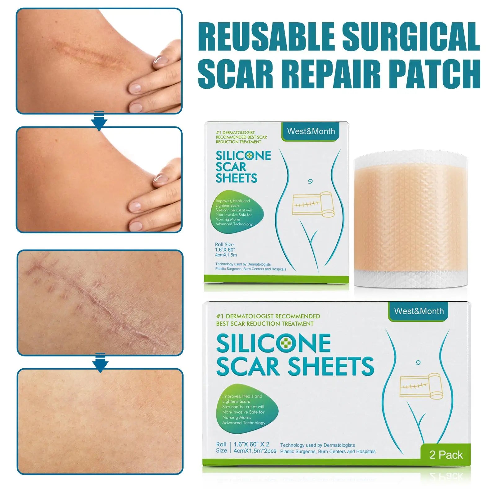 Silicon Scar Tape - Image 6