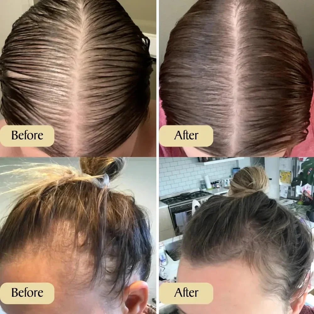 Natural Hair Growth Oil - Image 8