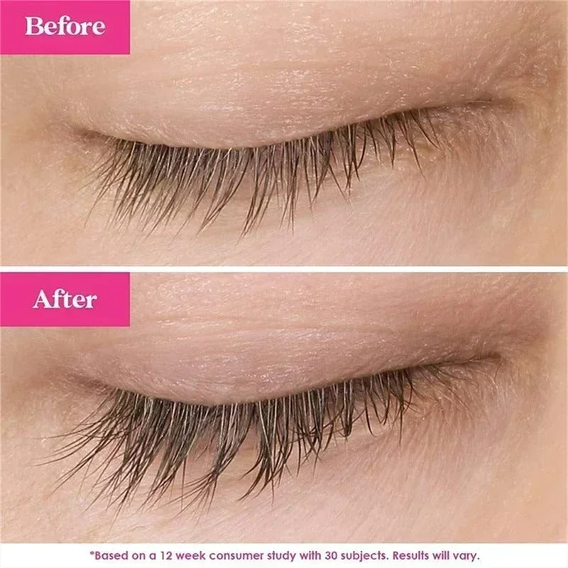 Ibealee Eyelash Serum Achieve 12Mm Longer Lashes (8Ml) - Image 5