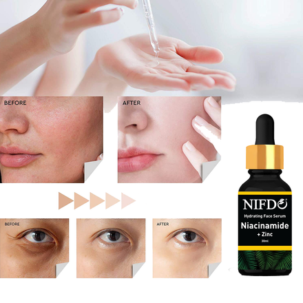 Nifdo Skin Brightening Serum with Niacinamide and Zinc, Hydrating Face Serum, anti acne serum