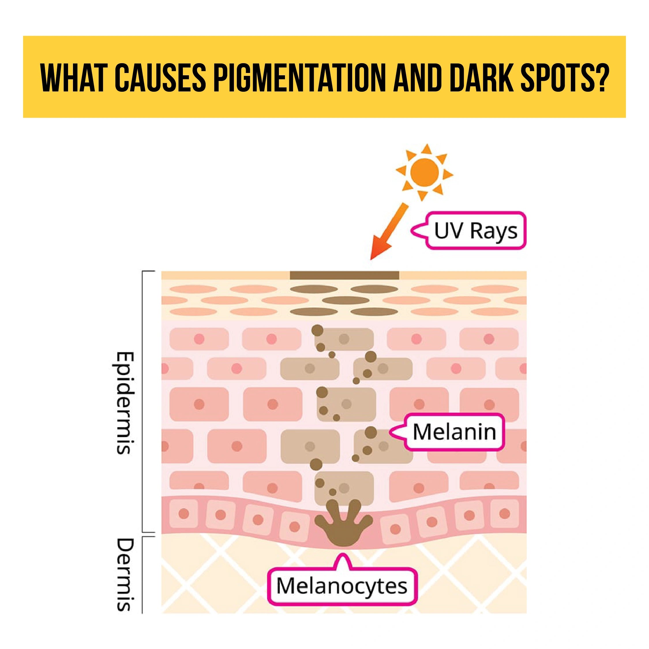 Causes of Dark Spots and Pigmentation