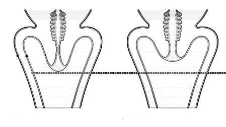 changes in cervix position