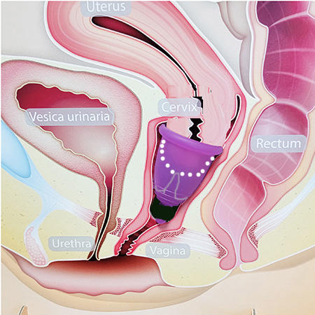 cervix sitting inside menstrual cup
