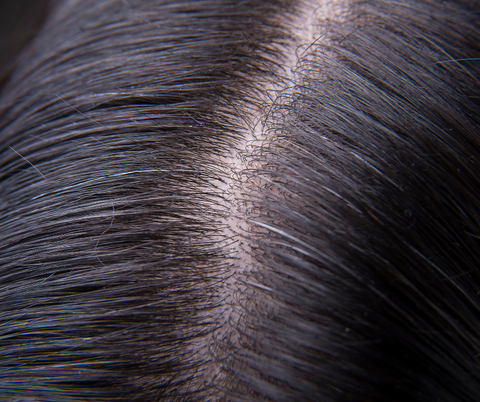 close up view of scalp