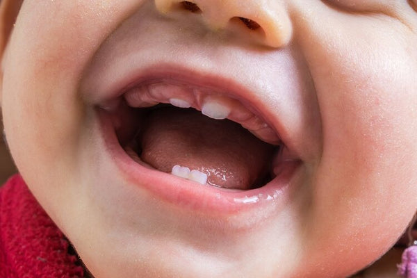 Baby Teeth dental care
