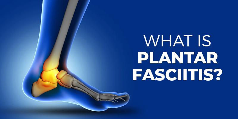 What is Plantar Fasciitis