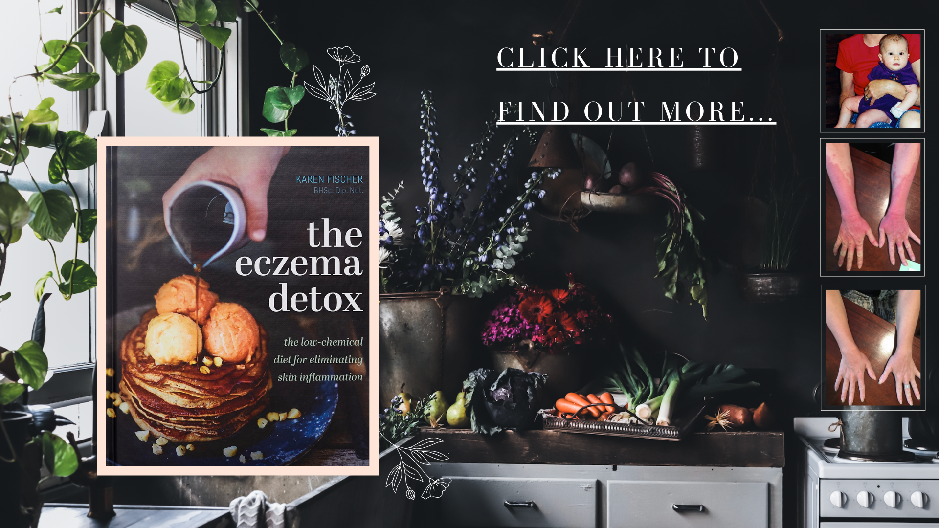 the eczema detox book by Karen Fischer