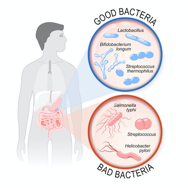 Gut flora and eczema image