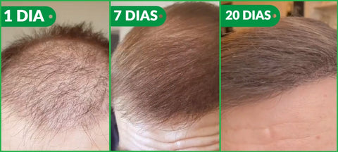 Repair Hair Funciona mesmo, evolução do crescimento do cabelo em 20 dias.