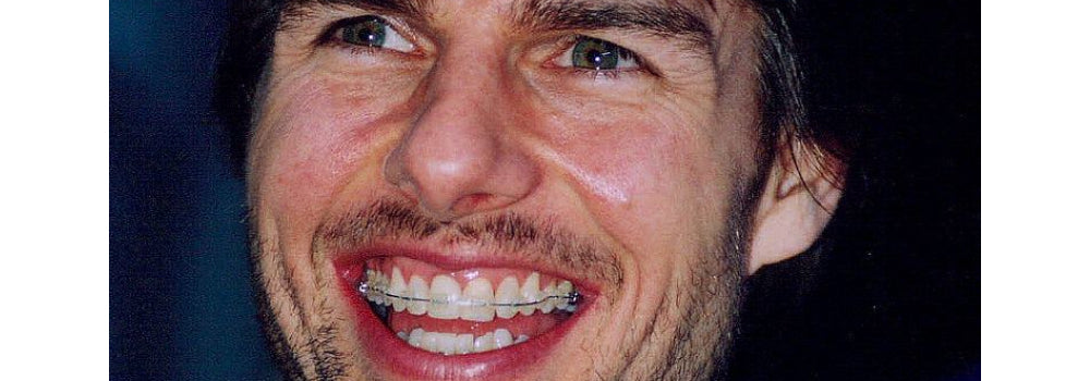 Tom Cruise braces