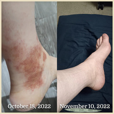 Before & After