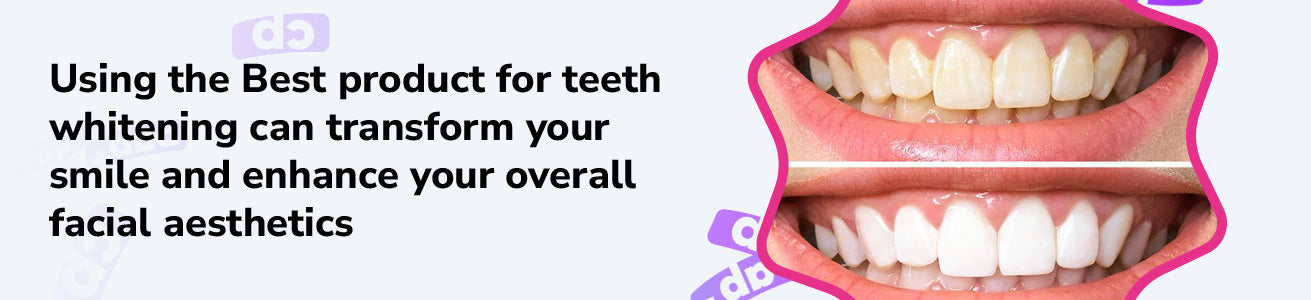 In pursuit of achieving pearly whites, the market is flooded with various teeth whitening kits, making it challenging to find one that truly lives up to its claims.