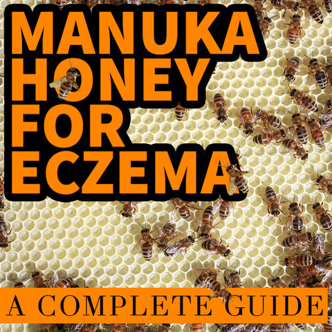 Top Eczema Treatments - Manuka Honey for Eczema