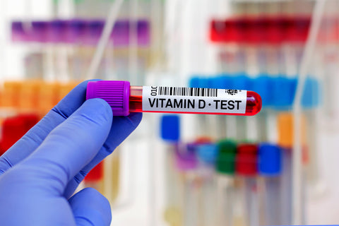 Test de sangre Vitamina D