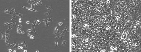 Fluc-neo transduced hepa1-6 cells