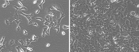 hepa1-6 iRFP-puro transduced cell morphology