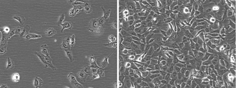 HT1080-hNIS-Ne0/iRFP-Puro cells show normal HT1080 morphology