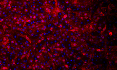 Immunofluorescent staining of sodium iodide symporter (NIS) expressing Mel624 cells stained with anti-NIS Vj1 antibody using Alexa 555 secondary