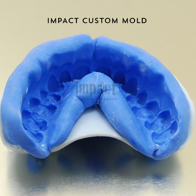 Provide Your Own Teeth Mold  Mouthpiece Guy Custom Mouthguards