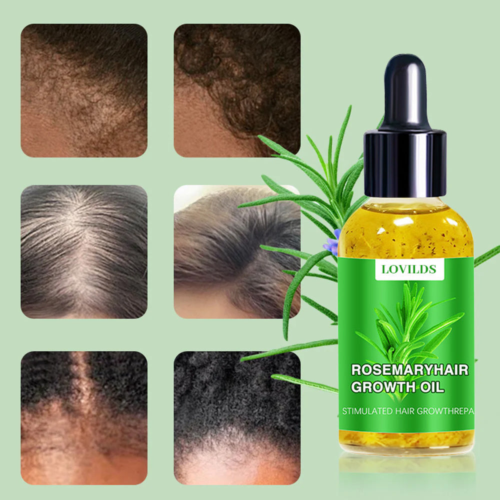 LOVILDS™ Hair Growth Serum