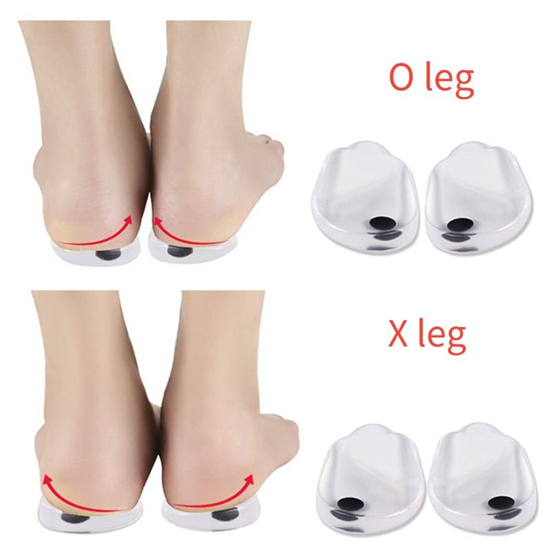 OrthoPads: Leg & Knee Correcting Insoles