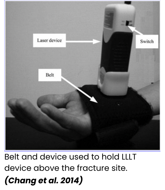 Belt used to hold the red light therapy laser device above a fracture site to heal the bone