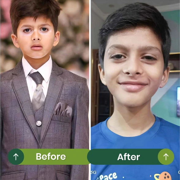 Before and After 1