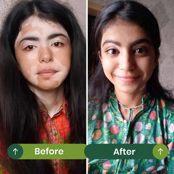 Before and After 2
