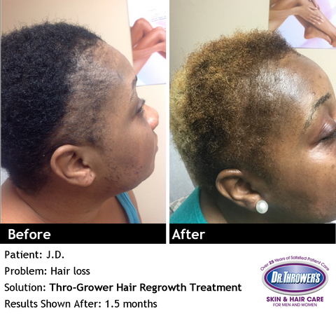 Hair and Skin Before & After Photos – Dr. Thrower's Skin Care