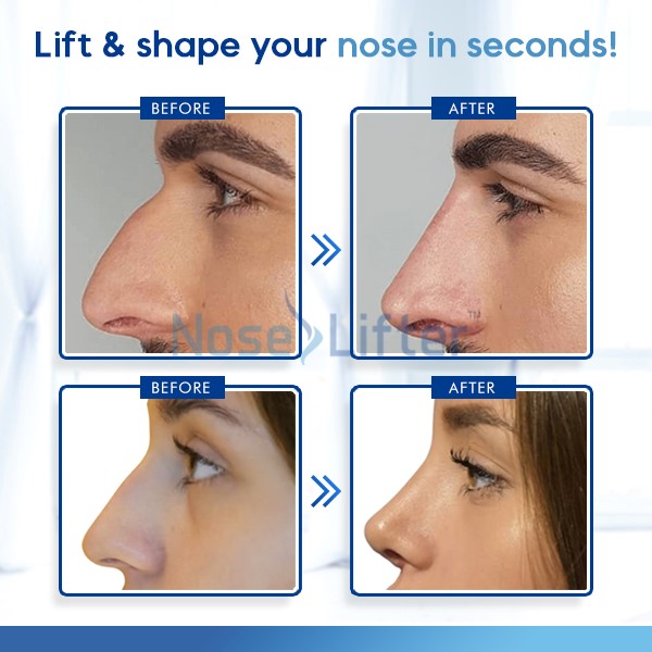 english nose shape