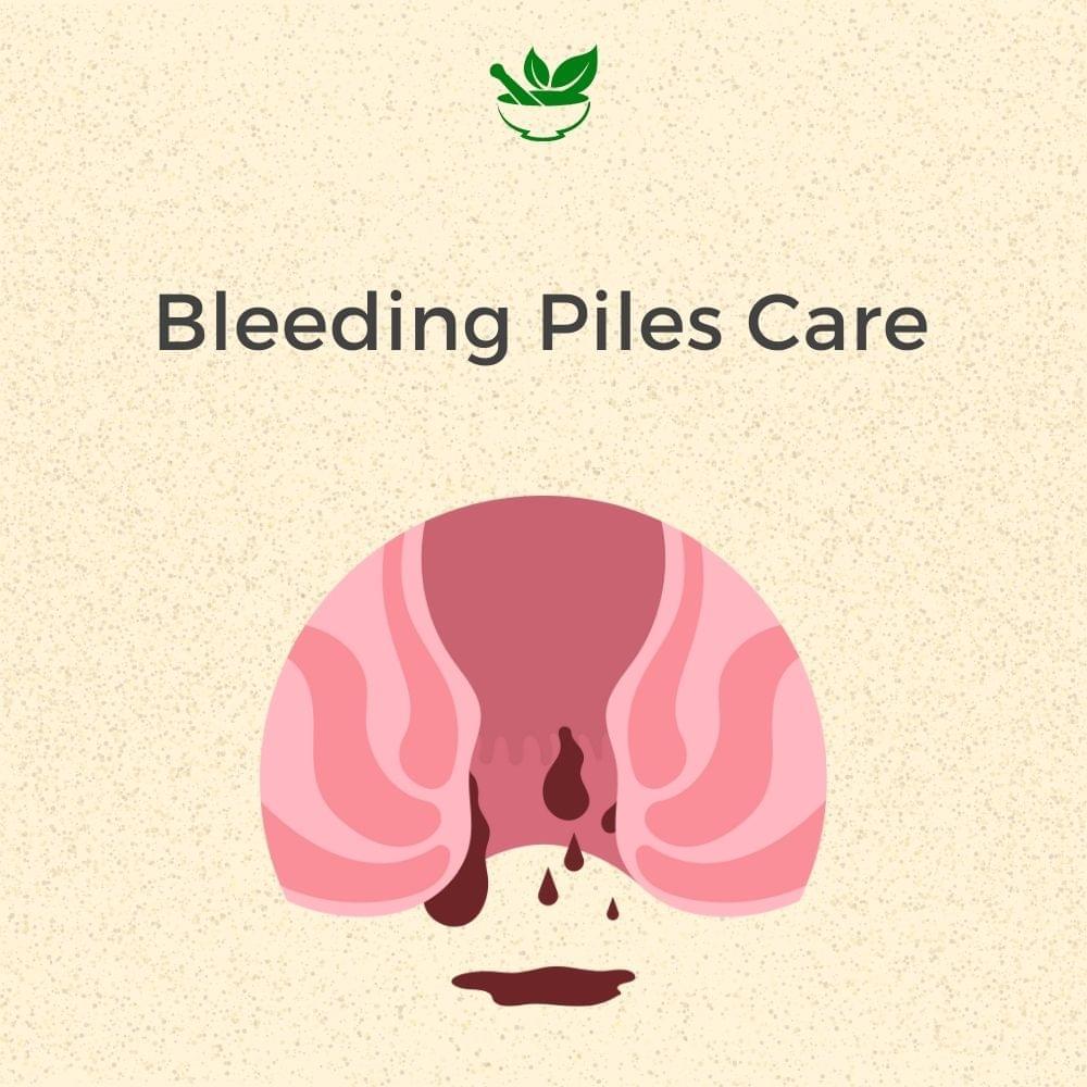 bleeding piles ayurvedic mangement 30 days pack Kits of  4 QTY