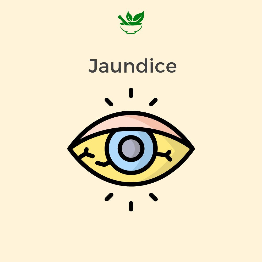 jaundice ayurvedic mangement 30 days pack Kits of  4 QTY