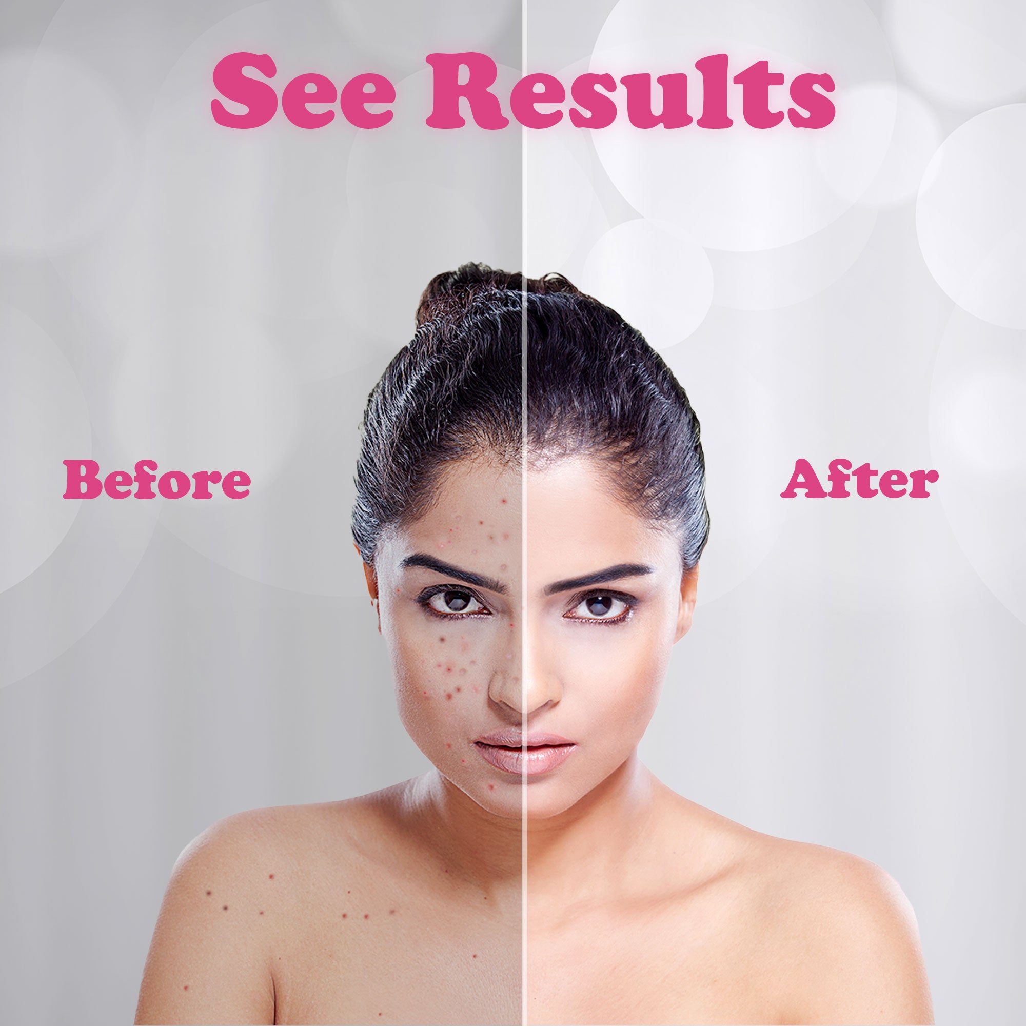 Woman's face showing skincare results: before with blemishes, after with clear skin.