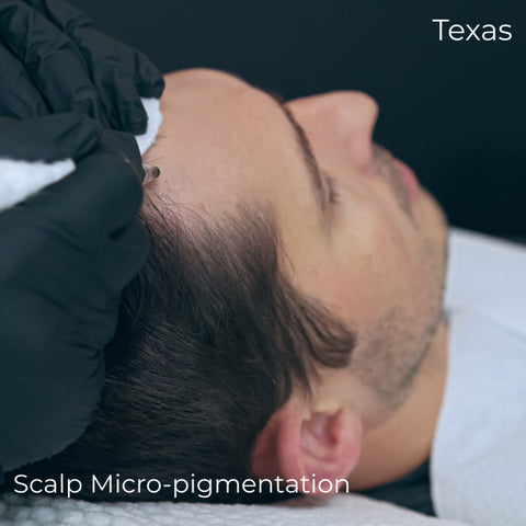 What is Scalp Micropigmentation ?