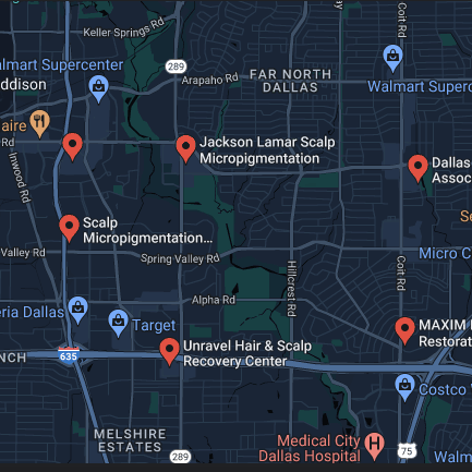 Scalp micropigmentation in Dallas