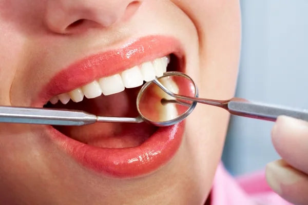  Closeup of a person getting a dental check-up